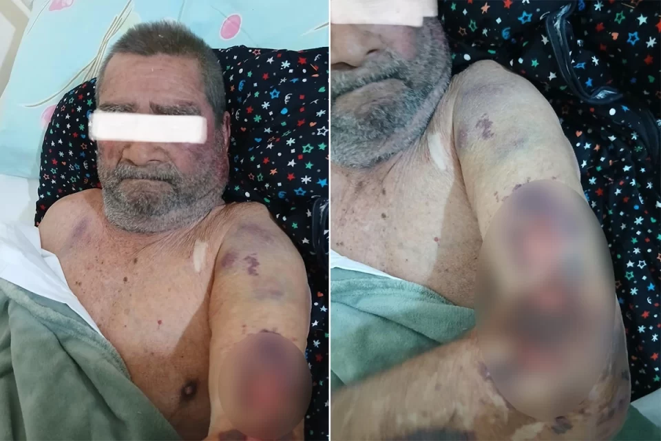 Violento asalto en Viale: golpearon y maniataron a un jubilado con movilidad reducida