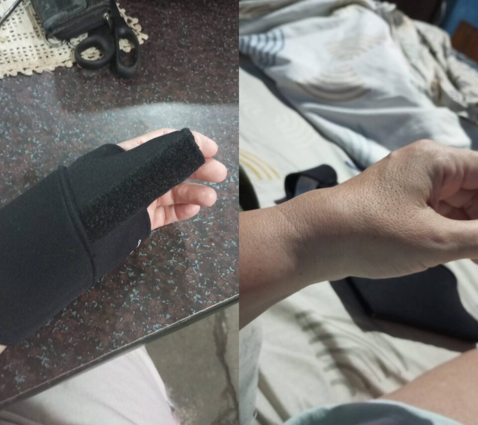 Un accidente que desnuda la falta de prevención