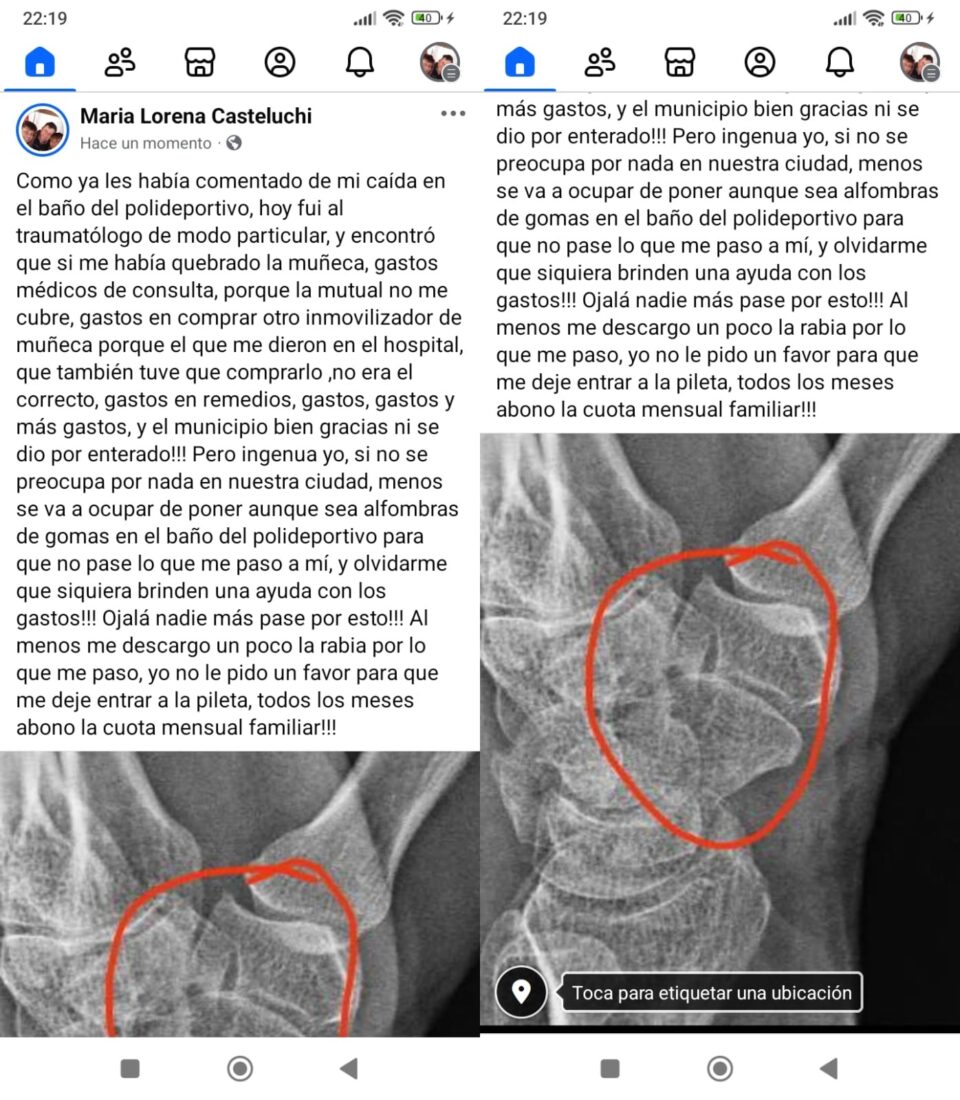 “Una caída que desnuda la falta de prevención en el Poli Municipal”