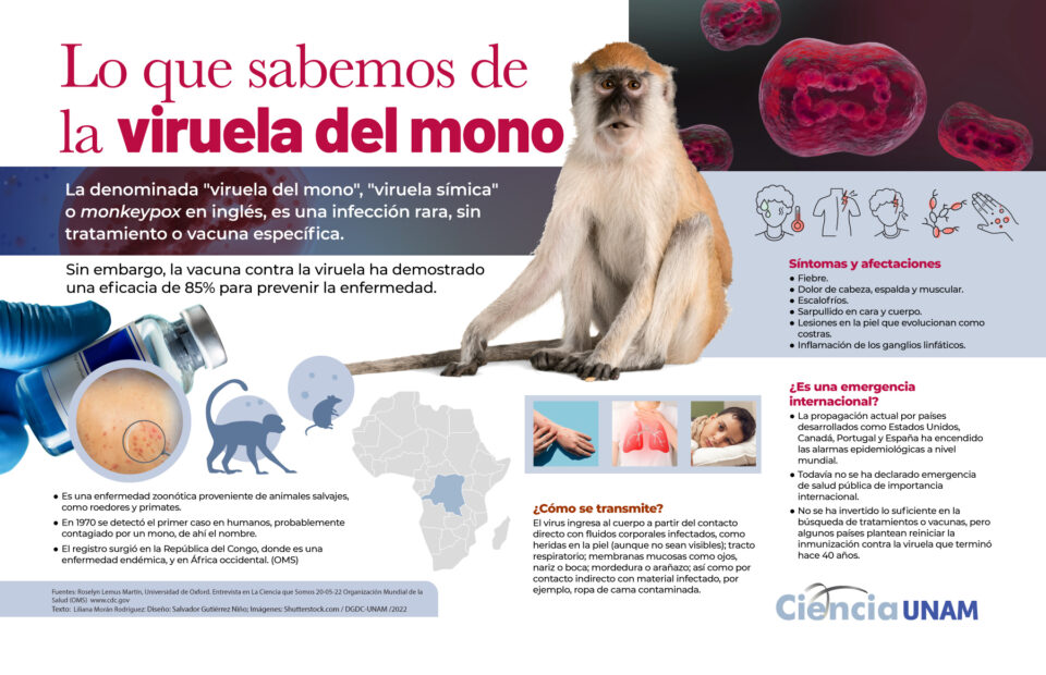 Viruela del mono: el primer caso severo que alerta a la Argentina
